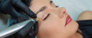 Non-Surgical Blepharoplasty for Eyelids